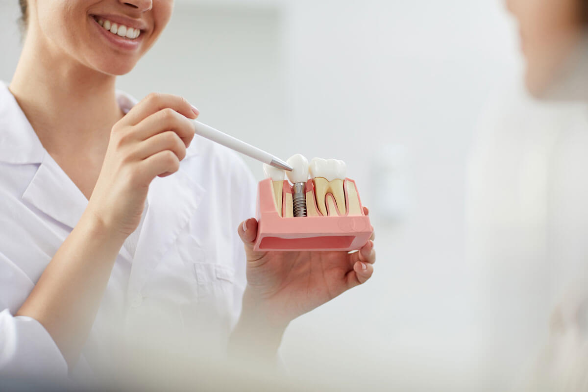 woman holding dental implant model and pointing to it